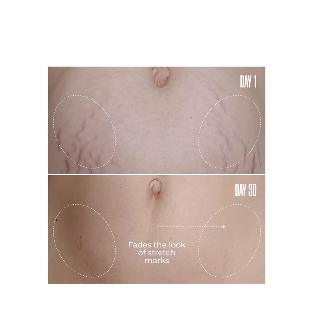 MAËLYS B-FLAT Belly Firming Cream - Vibrant Orange - Picture 3 of 9